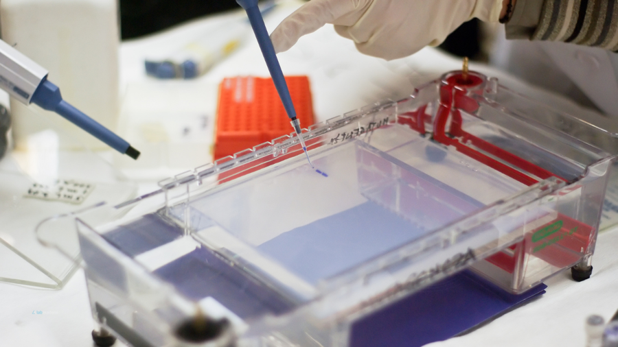 Moleküler Ayrıştırmanın Teorik Temeli: Jel Elektroforezi ve Analitik Uygulamaları